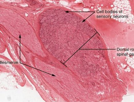 Dorsal Root Ganglion